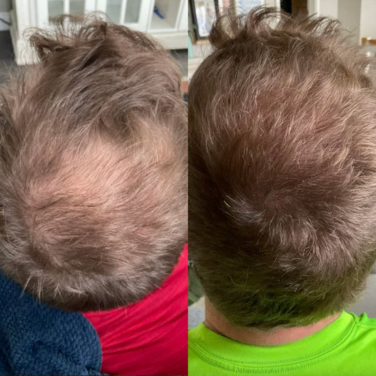 Nuvellus - Advanced Hair Growth Roll On Serum