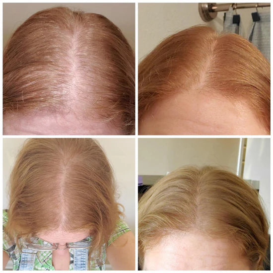 Nuvellus™ Advanced Hair Growth Roll-On Serum