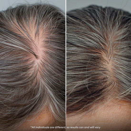Nuvellus - Advanced Hair Growth Roll On Serum